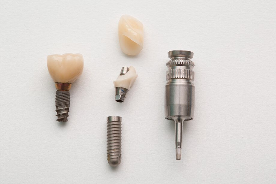 Имплантация зубов mobile