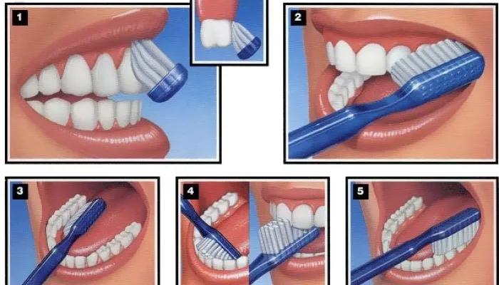 техника чистки зубов