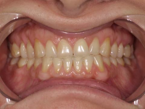 Осмотр у стоматолога-ортопеда